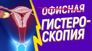 МИФЫ офисной гистероскопии Почему не нужно ее делать! Пайпель-биопсия. Диагностическое выскабливание