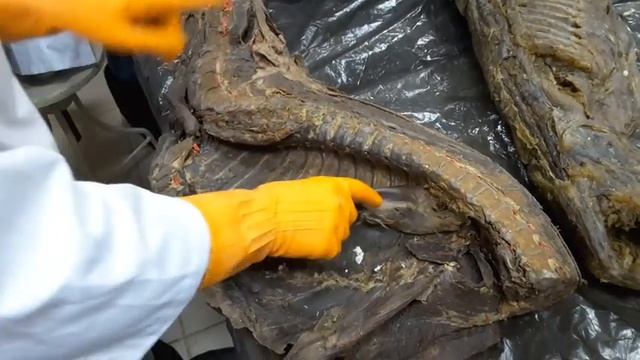 Мышцы грудной клетки и брюшной стенки. смотреть онлайн