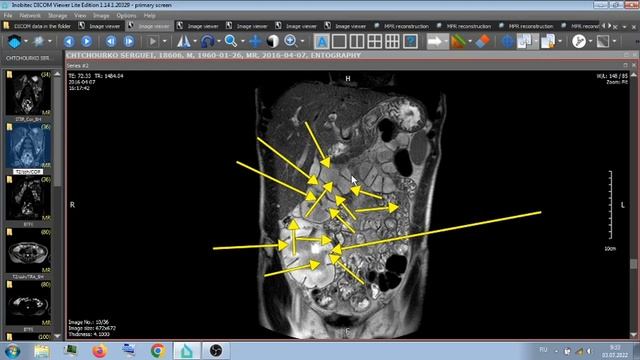 ЕСЛИ КОМУ ИНТЕРЕСНО - С ЧЕГО ВСЁ НАЧИНАЛОСЬ . смотреть онлайн