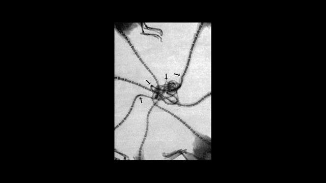 Крысиный король: миф или реальность смотреть онлайн