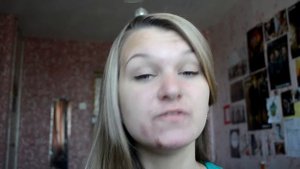 Роаккутан.96день./Озонотерапия: ощущения и первые последствия.