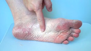 Педикюр  в домашних условиях без боли и риска | японские носочки для педикюра | гладкие  пятки