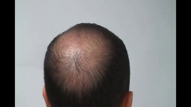 Топпик: густая шевелюра за 30 секунд! смотреть онлайн