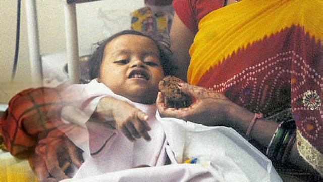 TODO SOBRE EL CASO DE LAKSHMI TATMA // LA BEBE CON 4 BRAZOS Y PIERNAS смотреть онлайн