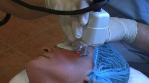 Лазерное омоложение лица.