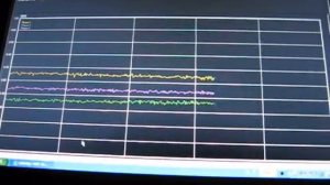 Диагностика системой CDS