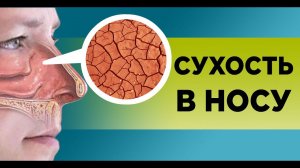 СУХОСТЬ В НОСУ