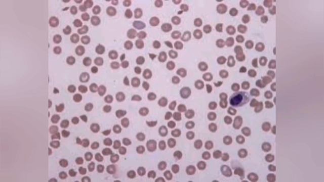 Escherichia coli смотреть онлайн