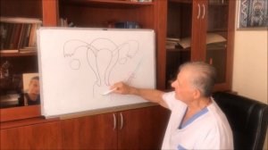 Бесплодие. Восстановление проходимости маточных труб стентированием.