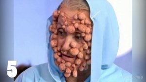 10 САМЫХ СТРАШНЫХ МУТАЦИЙ