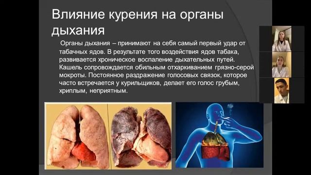 ЯГМУ. Секция для студентов СПО смотреть онлайн