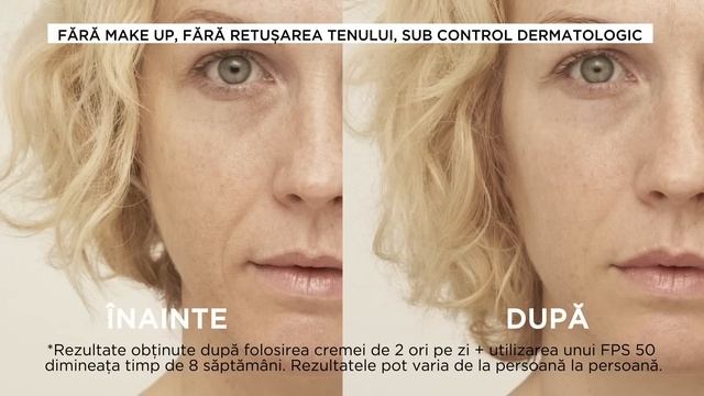 Formula noua! Revitalift Laser de la L'Oreal Paris смотреть онлайн