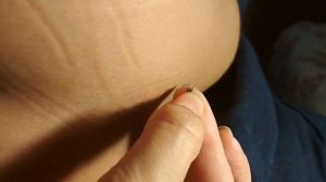 КАК ВЫТАЩИТЬ КЛЕЩА ОДНИМ ПАЛЬЦЕМ ?