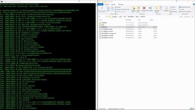 Anatomy of a DICOM file | DICOM 1 смотреть онлайн