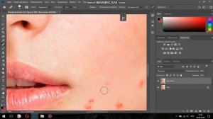 Инструмент восстанавливающая кисть в фотошопе , убираем прыщи на коже , Photoshop, Урок 5
