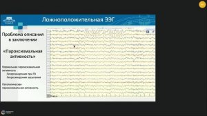 Синкин М.В. Методология проведения и описания амбулаторной ЭЭГ. Вебинар на площадке НПКЦ ДиТ ДЗМ