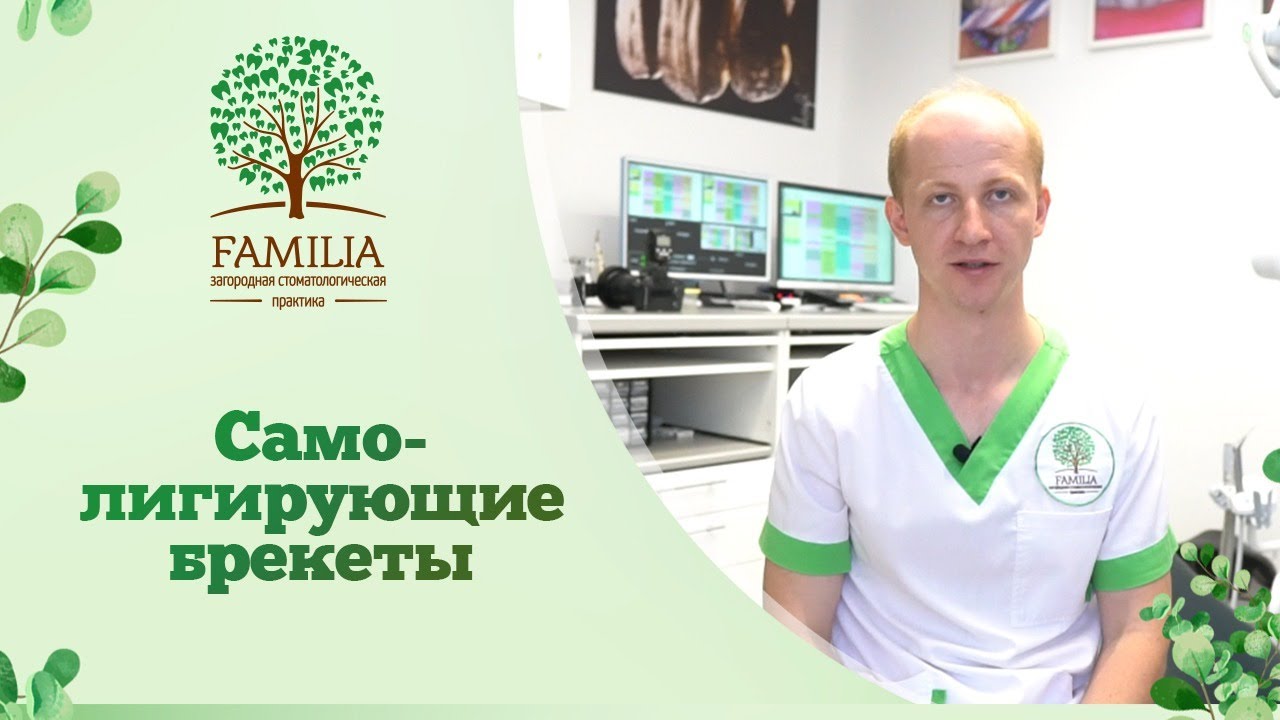 ? Самолигирующие брекеты