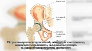 Синовит тазобедренного сустава