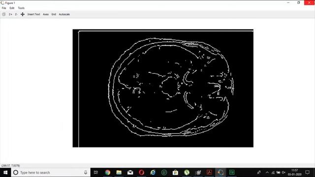 EDGE DETECTION TECHNIQUES USING OCTAVE (ROBERTS,PREWITT,SOBEL,LAPLACIAN AND CANNY EDGE DETECTION) смотреть онлайн