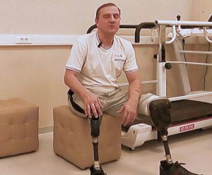 На ПРОТЕЗАХ НОГ учусь ХОДИТЬ без костылей. Эпилог.