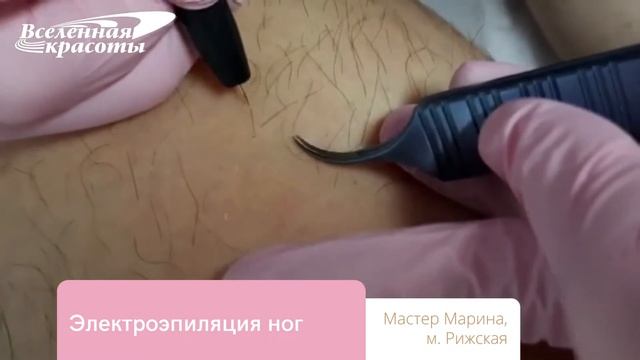 Электроэпиляция ног методом Blend