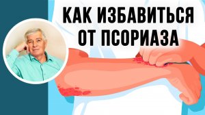 Как избавиться от псориаза. Руденко В.В. Академия Целителей.mp4