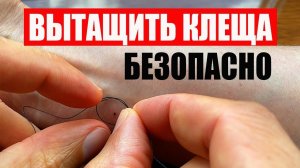 Как Вытащить Клеща Ниткой БЕЗОПАСНО. Что делать. How to remove tick