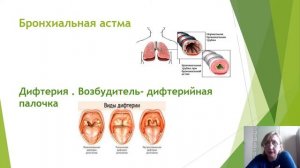 Заболевания дыхательной системы