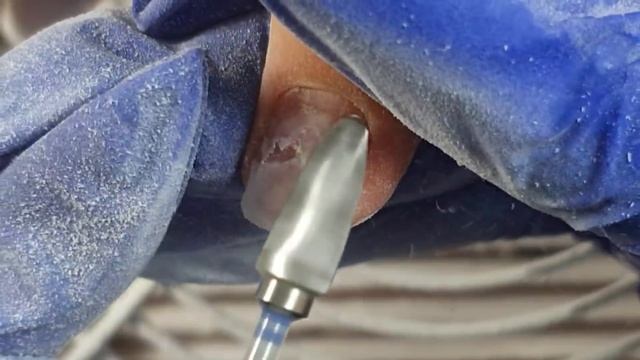 КОРРЕКЦИЯ ЗАПРЕЩЕНА❌/КАК УКРЕПИТЬ СЛАБЫЕ НОГТИ ⁉️ ПОКРЫТИЕ ГЕЛЬ ЛАКОМ/УКРЕПЛЕНИЕ НОГТЕЙ ⚒ смотреть онлайн