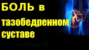 БОЛЬ В ТАЗОБЕДРЕННОМ СУСТАВЕ как лечить?