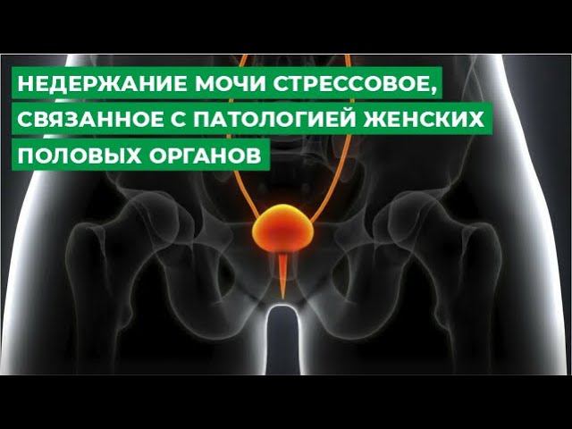 Недержание мочи стрессовое, связанное с патологией женских половых органов