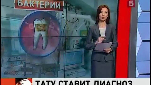 Чип