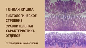 Тонкая кишка. Гистологическое строение. Сравнительная характеристика отделов