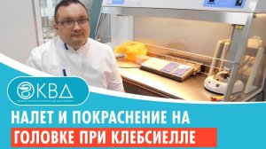 ? Налет и покраснение на головке при клебсиелле. Клинический случай №971