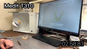 Сравнение Medit T310 vs Exostom RapidScan