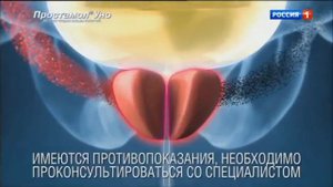 Простамол Уно
