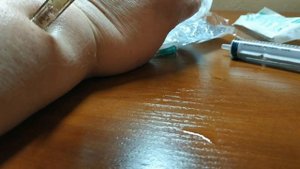 Безыгольный инъектор HYALURON PEN видео Обучение