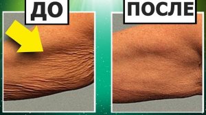 ПЕРЕКИСЬ ВОДОРОДА | Кожа, как в молодости