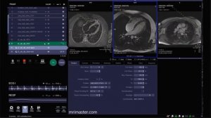 Планинг МРТ СЕРДЦА на новом интерфейсе аппарата  МРТ Сименс.
