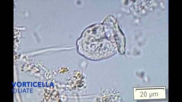 ciliate - vorticella - compost microbe смотреть онлайн