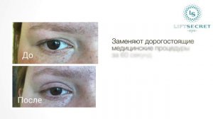 Лифтинг-полоски Eye Lift Secret для мгновенной коррекции век