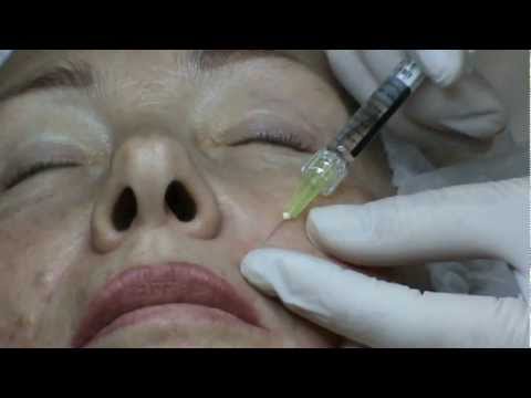 Princess Rich, биоревитализация лица, обучение, 111128 смотреть онлайн