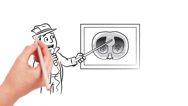 Get a live report out of the lung! Pulmonary monitoring with PulmoVista 500. смотреть онлайн