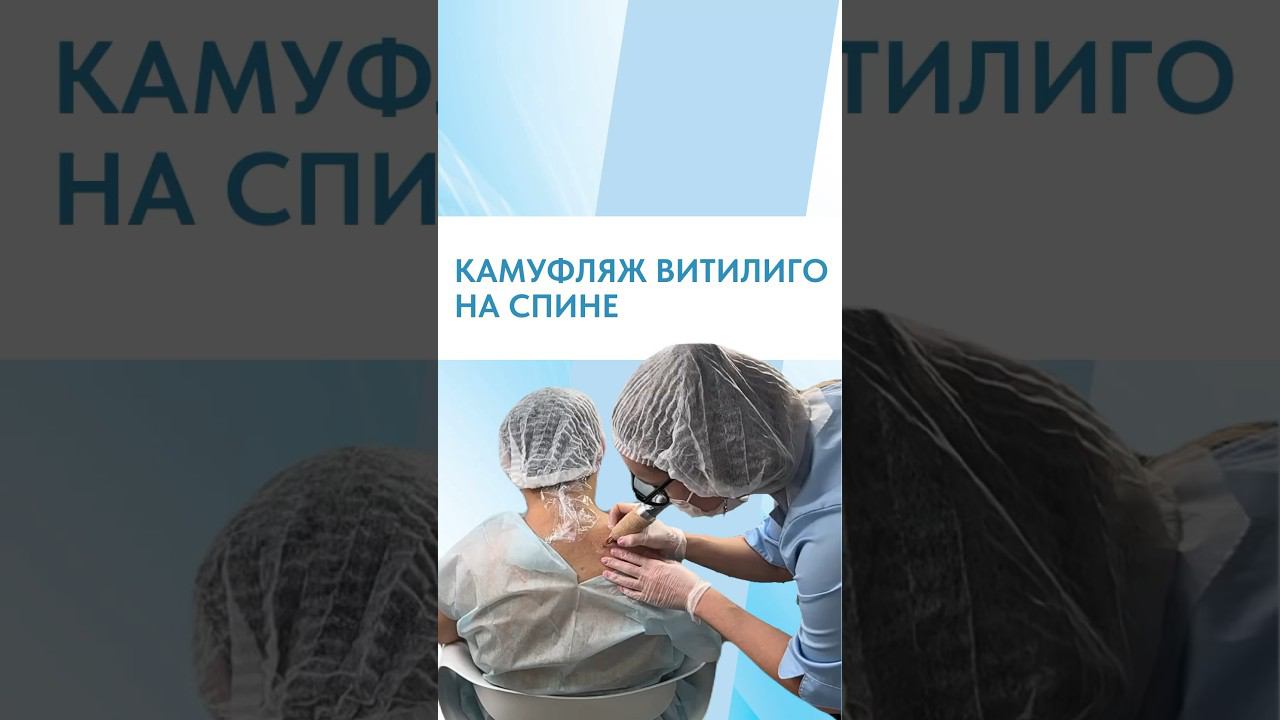 ВИТИЛИГО НА РАЗНЫХ УЧАСТКАХ ТЕЛА, КАК СКРЫТЬ?
