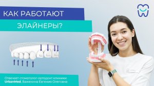 Как работают элайнеры?