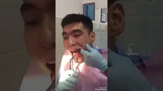 Удалил сам себе зуб мудрости смотреть онлайн