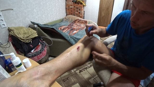 Порезал ногу бензопилой