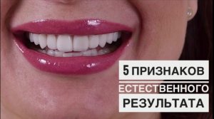 5 признаков естественного и натурального результата преображения улыбки