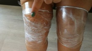 Сравнение анестетиков для электроэпиляции. DF Skincaine gel против J-cain.