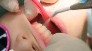 Чем лечить зубы.